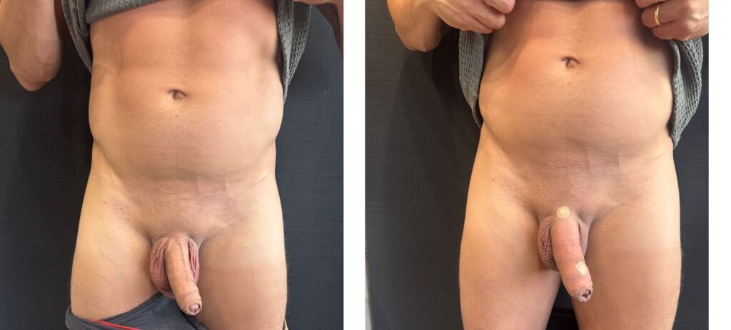 PRIME MEDICAL CENTER - AUMENTO PENIANO 1204 - ANTES E DEPOIS